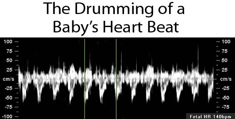 Baby heart beat1