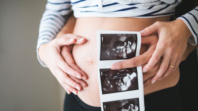 A9a295e9 3e7d 4cb2 94c5 3a0434a2c206