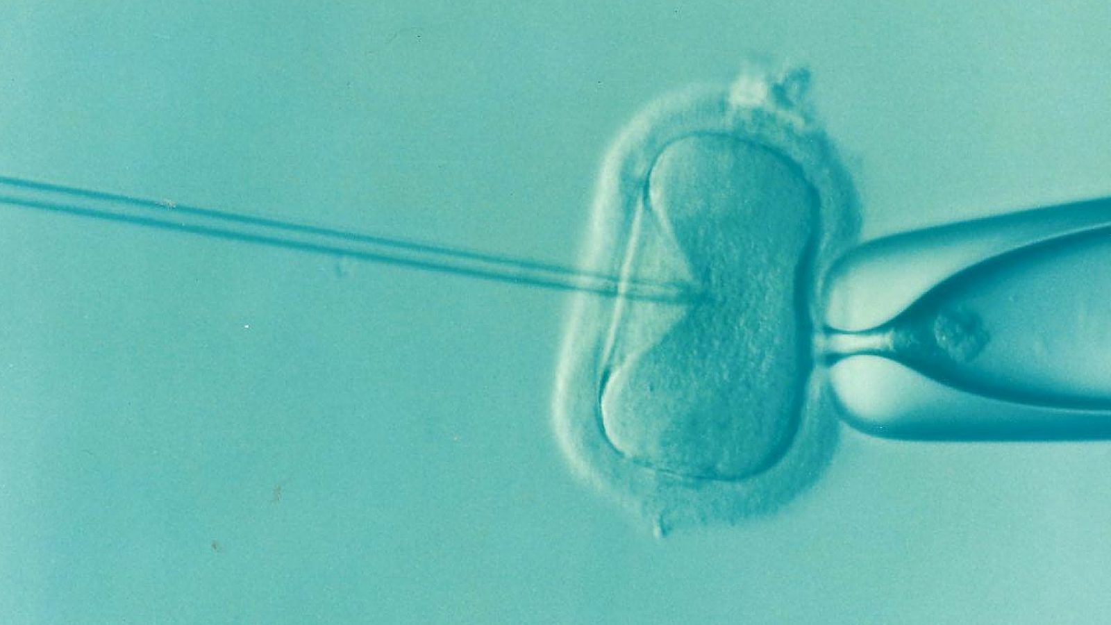 Ivf 1514174 1920